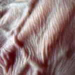 Closeup photo of wrinkled skin illustrating the anticipation wrinkle and the expectation wrinkle in addiction.