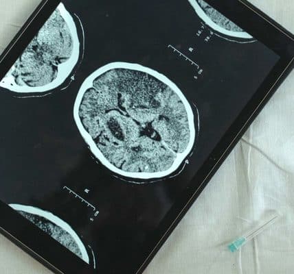 An image of a brain scan on a tablet.