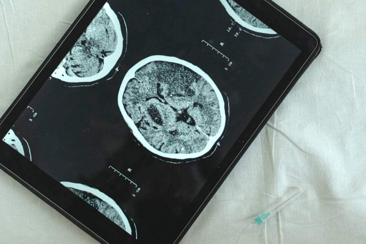 Drawing on the Calm Side of the Brain